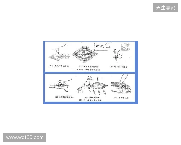 广州豹官方：杨浩眉弓伤口缝合30余针，预计5-7天后拆线